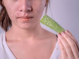5 Benefits Of Applying Aloe Vera Gel On Face Overnight Bright Stuffs 5 benefits of applying aloe vera gel on