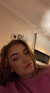 Dental nurse left unable to smile after she treated herself to cut-price  lip fillers last Christmas warns others not to “cheap out”