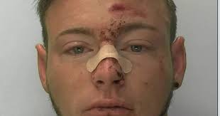 Ex-paratrooper used Kung Fu skills to attack police at Gloucester nightclub 