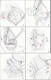 Also contributes to the common calcanean tendon (in the cat). Schematic Drawing Of The Anatomy Of The Canine Right Perineal Region Download Scientific Diagram