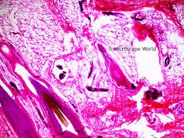 Maybe you would like to learn more about one of these? Microscope World Blog Scalp With Hair Under The Microscope