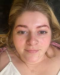 Payton Foley (@myelitemedspa.payton) · Instagram 照片和视频