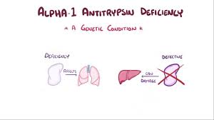 Alpha 1 Antitrypsin Deficiency Osmosis