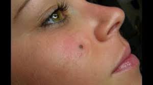 Beauty Mark Create Beauty Face Be Beauty Tips