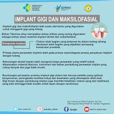 Menanam gigi palsu dengan cara implan bisa bertahan lebih lama, dibandingkan dengan gigi tiruan sementara. Rsup Dr Sardjito Implant Gigi Dan Maksilofasial