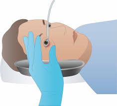 Image result for Eye Irrigation