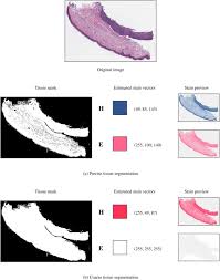 There are a variety of stains that can be used in microscopy. A Novel Method For Tissue Segmentation In High Resolution H E Stained Histopathological Whole Slide Images Sciencedirect