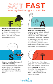 If you suspect you or a loved one might be about to suffer a stroke, then it is … Warning Signs Of A Stroke Act Fast