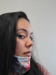 How to fix forehead depressions? Makes me look like I'm anxious all the  time. (photos)