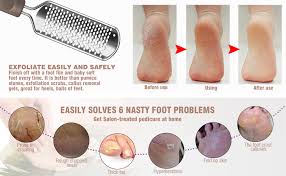 The tool is designed to work slowly, with a light touch and many repeated strokes. Amazon Com Colossal Foot Grater Foot File Foot Rasp Callus Remover Btartbox Large Stainless Steel Foot Scrubber Foot Care Pedicure Tools For Wet And Dry Feet Beauty
