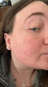 What are good self-tanners for people who can't tan?