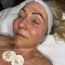 Pretty Little Face Aesthetics‎