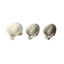 Image result for Temporal Bone