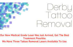 All common coloured tattoos blue, dark blue, sky blue, green, yellow, and red can be treated. Derby Tattoo Removal Home Facebook