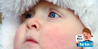 Check spelling or type a new query. Asi Bukan Penyebab Ruam Susu Pada Bayi Ketahui Cara Mengobatinya Tirto Id