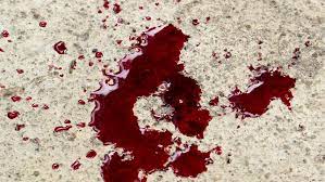 Maybe you would like to learn more about one of these? Blood Dropping Onto Wood Floor Stock Footage Video 100 Royalty Free 15653992 Shutterstock