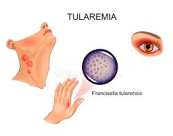 National institute of allergy and infectious disease (niaid) laboratory of intracellular parasites. Global Tularemia Market 2021 Is Astonishing Growth Nicholas Piramal Alkem Glaxo Smithkline Bayer Ag Ranbaxy Laboratories Cipla The Courier