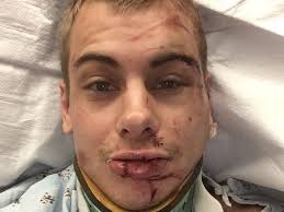 Fundraiser by Megan Hansen : Help Jesse get back