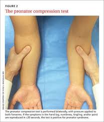 Image result for Carpal Compression Test