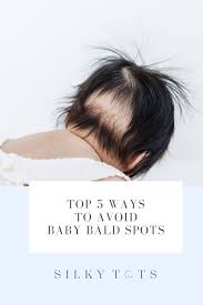 Early signs of hair loss new moms: How To Stop Baby Bald Spots In 2020 Baby Losing Hair Baby Life Hacks Baby Hair Loss