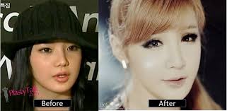 She was the group's main vocalist. Park Bom S Drastic Plastic Surgery Transformation Shocked Fans Plastytalk
