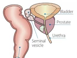 Problems urinating, including a slow or weak urinary stream or the need to urinate more often, especially at night Prostate Cancer Irish Cancer Society
