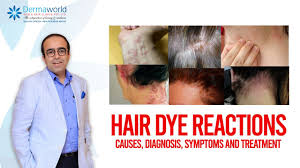 With that said, let's look at how to remove hair dye from the hairline. Hair Dye Allergy Treatment Causes Prevention Dermaworld Skin Clinic