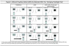 Pupil Size Chart Pdf Related Keywords Suggestions Pupil Size Chart Pdf Long Tail Keywords Keyword Suggestion Pupil Suggestion