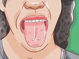 How to clean tongue piercing. How To Brush Your Teeth With A Tongue Piercing 14 Steps