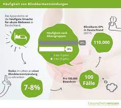 Blinddarmentzundung Schnell Erkennen Und Handeln