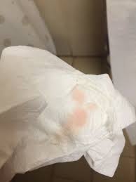 Light pink discharge during pregnancy no cramps adiklight co. Light Pink Blood When I Wiped Tmi Trying To Conceive Forums What To Expect