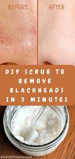 Pin On Skin Care