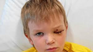 Miraculous recovery for boy doctors feared would lose sight