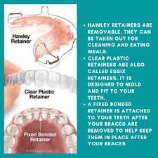 See full list on wikihow.com Straightline Orthodontics There Are Three Types Of Retainers That Dr Kara Might Prescribe You After Your Braces Treatment Here Is A Look At What Those Are Facebook