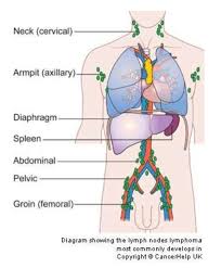 The stage of a cancer describes the size of a tumour and how far it has spread from where it originated. How Long Does It Take Cancer To Spread At Stage 4 Quora