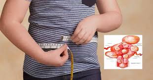 Ada temen yang sakit haidh padahal kami. Perut Buncit Senggugut Teruk Kerap Terkencing Susah Mengandung Wanita Mungkin Ada Fibroid