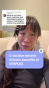 Replying to @Yvette Salinas #csectionscar wound closure
