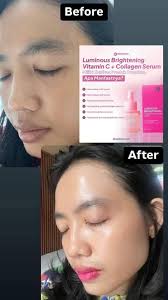 ✨ Kulit kusam, garis halus, tanda penuaan? Saatnya tampil lebih muda dan  bercahaya 💖 Dengan Serum DNA Salmon dari DRW Skincare, bantu regenerasi  kulit dari dalam dan kunci kelembapan alami wajahmu! 📌