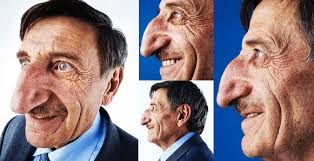 Maybe you would like to learn more about one of these? Meet Man With The Longest Nose In The World Photos Zaravibes
