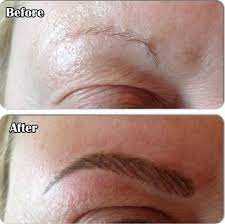 We did not find results for: Semi Or Easy Eyebrow Tattoo Cost And Before After Photos