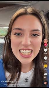 Madeline Grimaldi Before and After