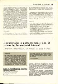 Image result for Craniotabes