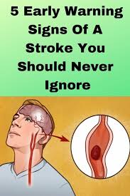 5 Early Warning Signs Of A Stroke You Should Never Ignore Warning Signs Brain System Severe Headache