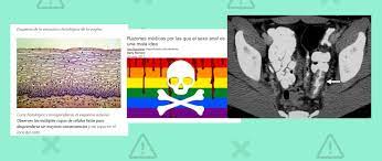 Cuidado con este contenido que afirma que el sexo anal es “perjudicial para  la salud”: con las medidas de prevención adecuadas, es una práctica  totalmente segura · Maldita.es - Periodismo para que