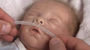 A nasal cannula is an oxygen delivery device frequently used by patients with copd. Medin Nuflow Nasal Cannulas Instructions For Use Youtube