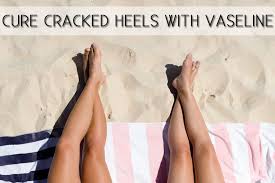 For Cracked Dry Feet Use Vaseline And Cotton Socks For An Overnight Miracle Beauty Hacks Beauty Tips For Skin Glowing Skin Diet
