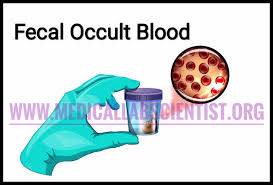 Faecal occult blood tests (fobt) are recognised as a useful tool for colorectal cancer screening. Faecal Occult Blood Tests Fobts Significance Methods Interpretation Interference