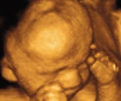 They confirmed the presence of a gestational sac, yolk sac and fetal dipole, but could not detect a heartbeat. You Are 27 Weeks And 6 Days Pregnant Familyeducation