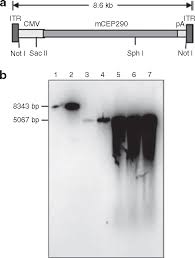 Image result for Black 1996 AAV