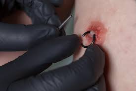 Best Piercing Numbing Cream (2024) | Tattoo Vagabond
